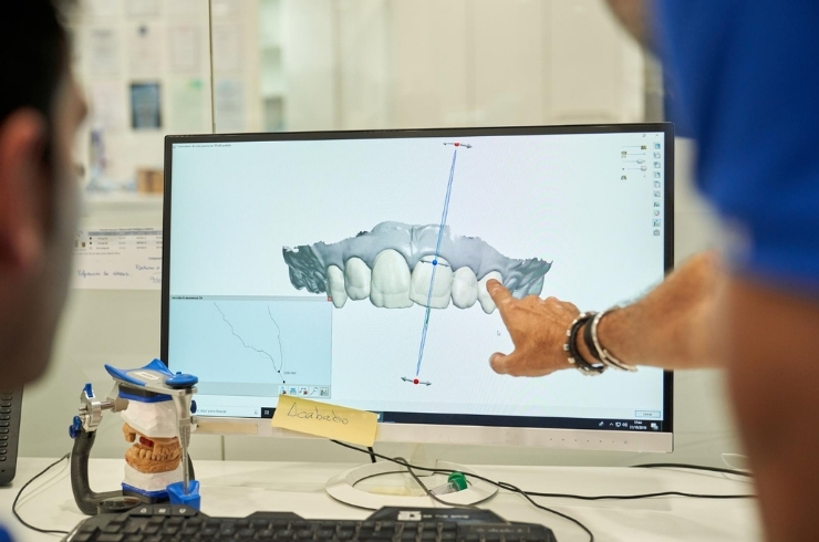 3D Intra Oral Scan